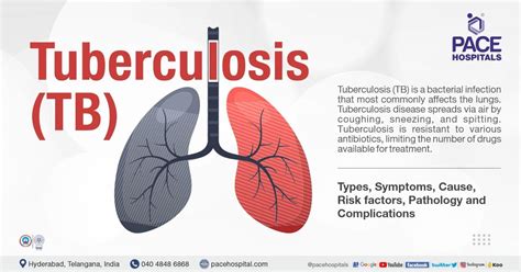 what does tb mean in shoes